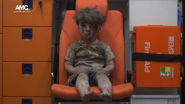 His name is Omran. The image of him, bloodied and covered with dust, sitting silently in an ambulance awaiting help, is another stark reminder of the toll of the war in Syria.